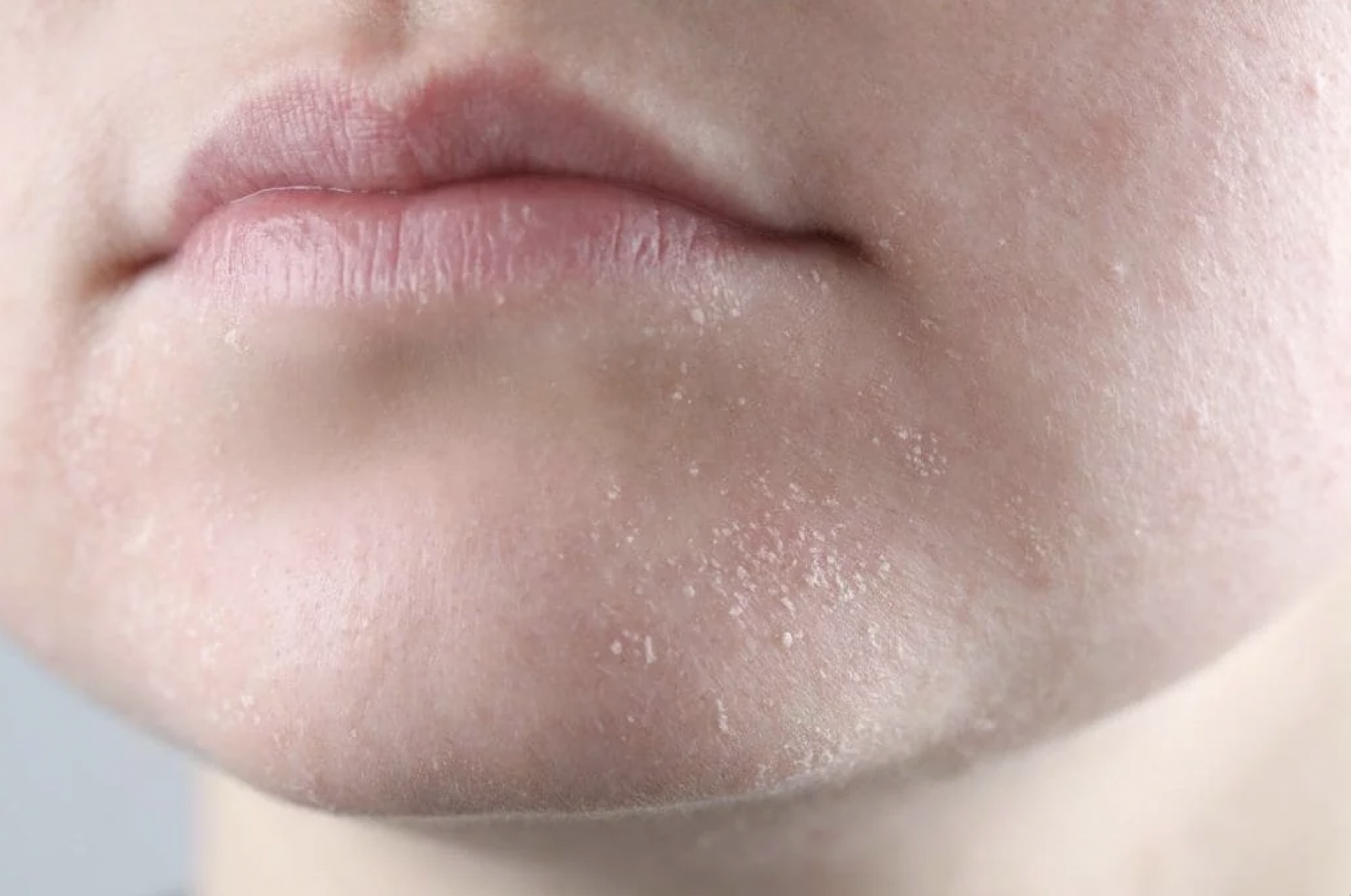 Da xỉn màu và sần có thể cải thiện khi được làm sạch dịu nhẹ và dưỡng ẩm phù hợp