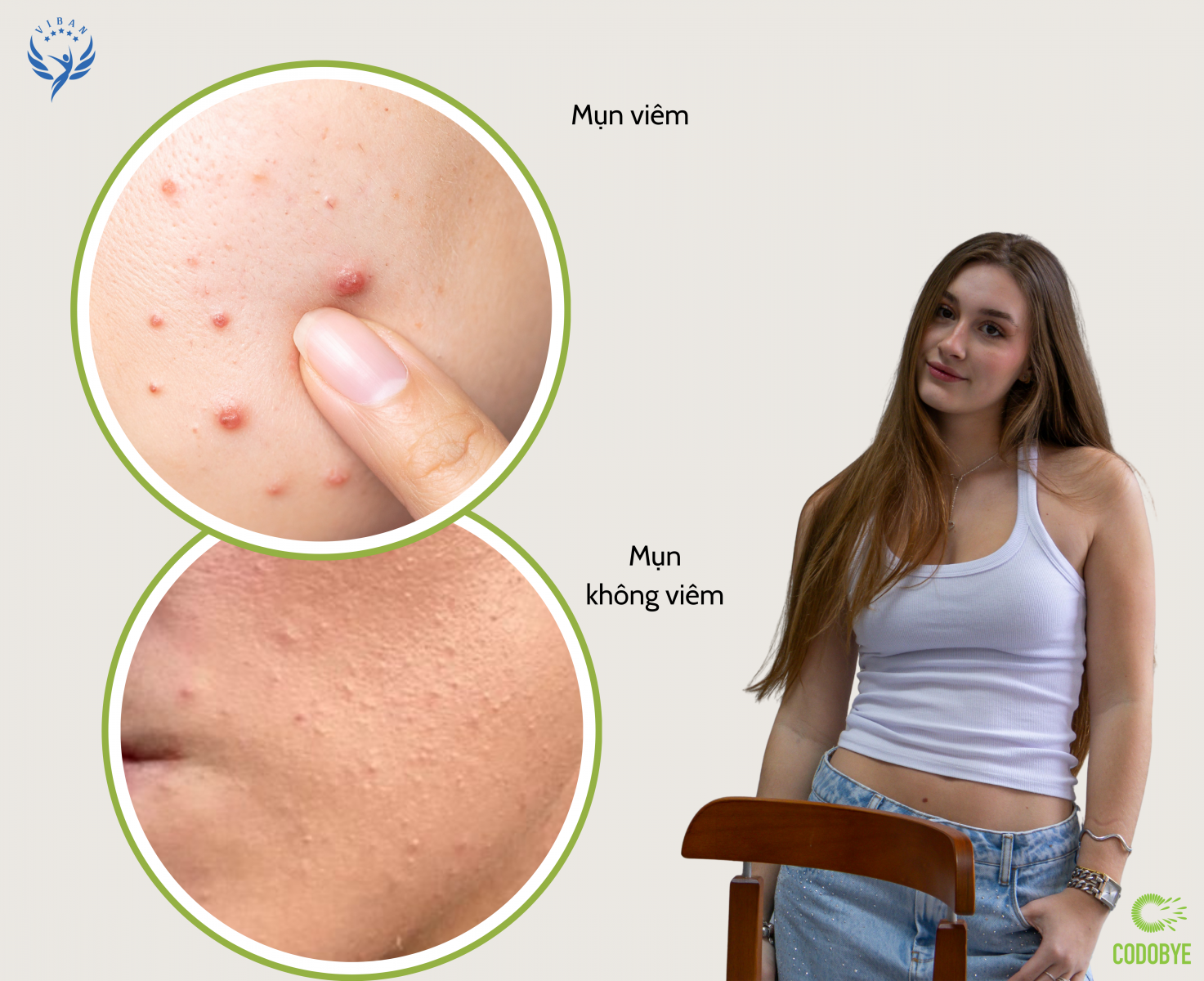 So sánh mụn viêm và mụn không viêm để xác định có nên xông hơi da mặt hay không