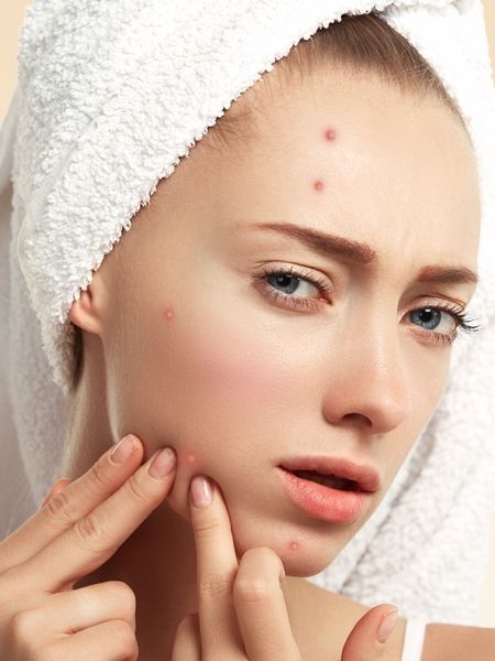 Vi khuẩn từ điện thoại gây viêm da